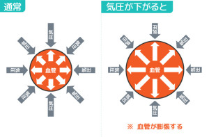 天気病4